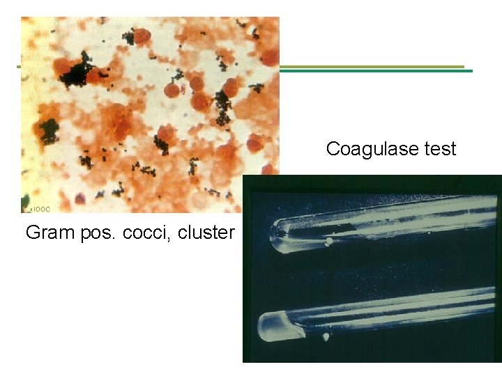 Coagulase test Gram pos. cocci, cluster 