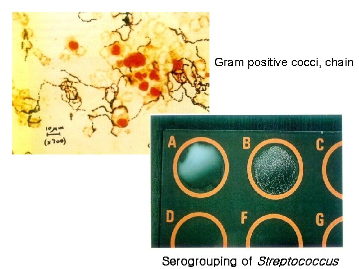 Gram positive cocci, chain Serogrouping of Streptococcus 