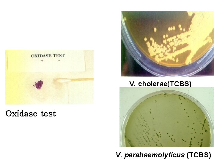 V. cholerae(TCBS) Oxidase test V. parahaemolyticus (TCBS) 