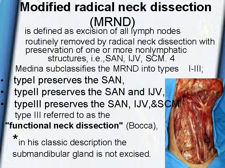 Modified radical neck dissection (MRND) is defined as excision of all lymph nodes routinely