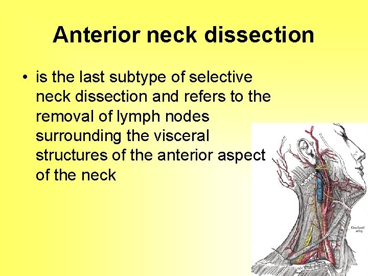 Anterior neck dissection • is the last subtype of selective neck dissection and refers