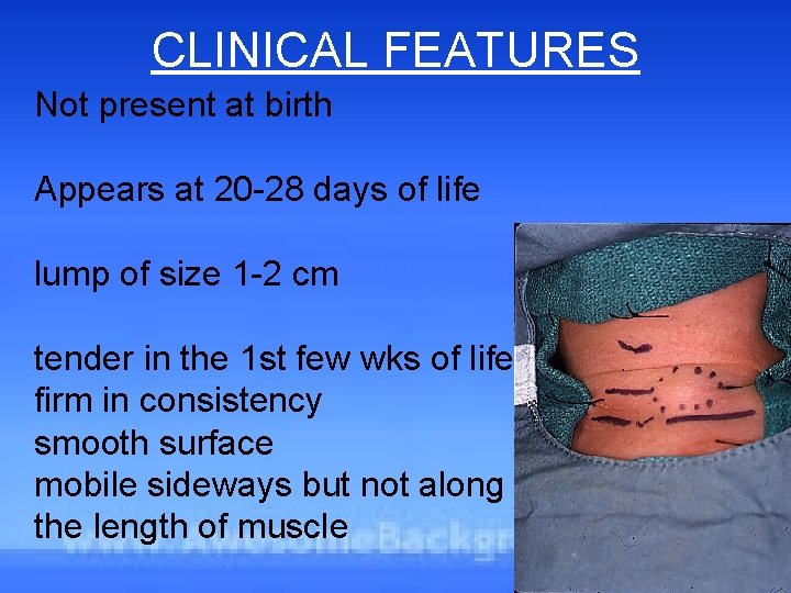 CLINICAL FEATURES Not present at birth Appears at 20 -28 days of life lump