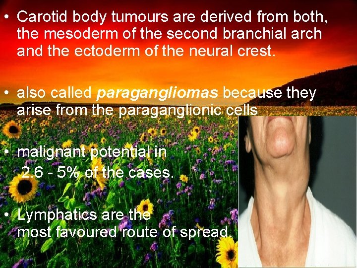  • Carotid body tumours are derived from both, the mesoderm of the second