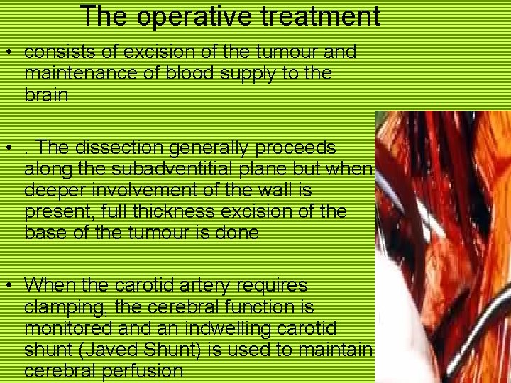 The operative treatment • consists of excision of the tumour and maintenance of blood
