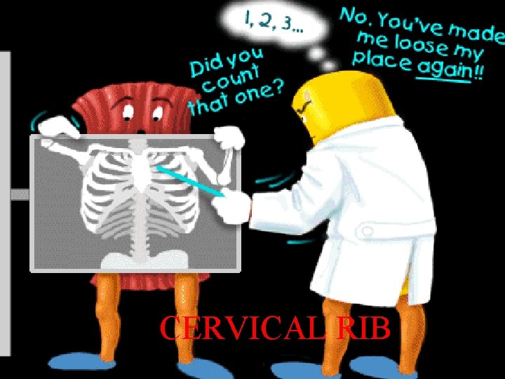 CERVICAL RIB 