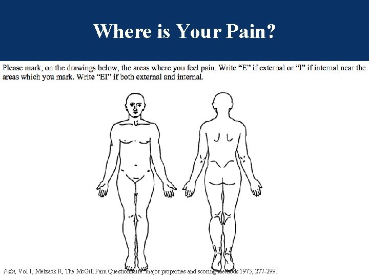Where is Your Pain? Columbia Orthopaedics Pain, Vol 1, Melzack R, The Mc. Gill