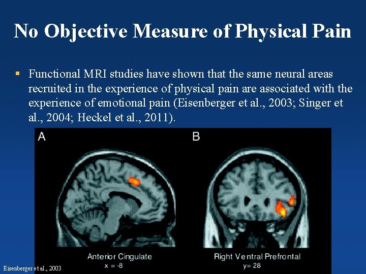 No Objective Measure of Physical Pain § Functional MRI studies have shown that the