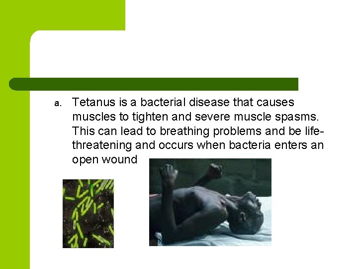 a. Tetanus is a bacterial disease that causes muscles to tighten and severe muscle