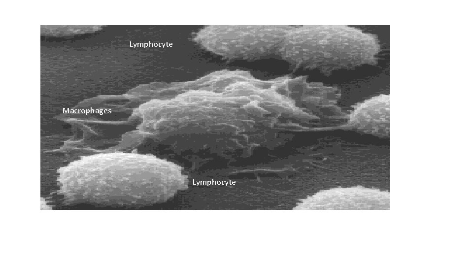 Lymphocyte Macrophages Lymphocyte 