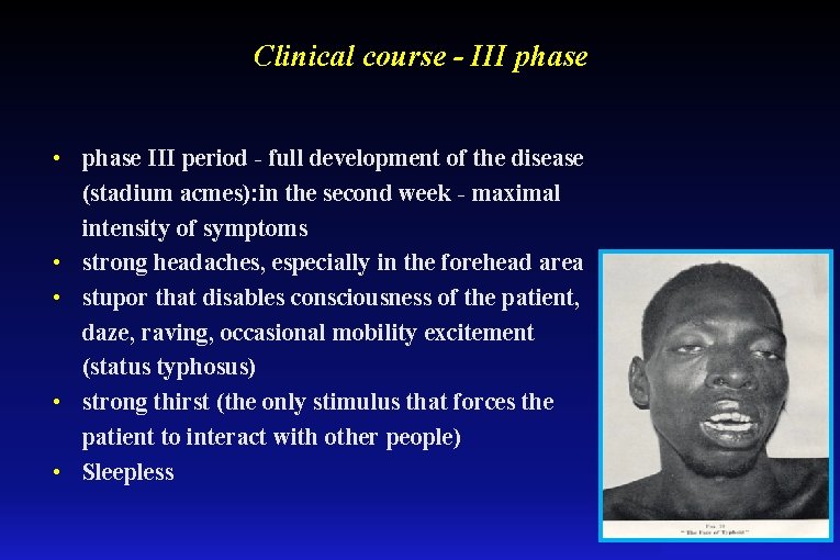 Clinical course - III phase • phase III period - full development of the