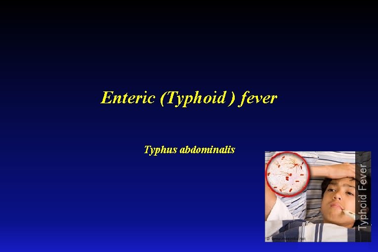 Enteric (Typhoid ) fever Typhus abdominalis 