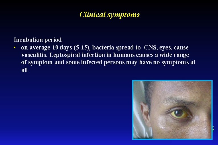 Clinical symptoms Incubation period • on average 10 days (5 -15), bacteria spread to