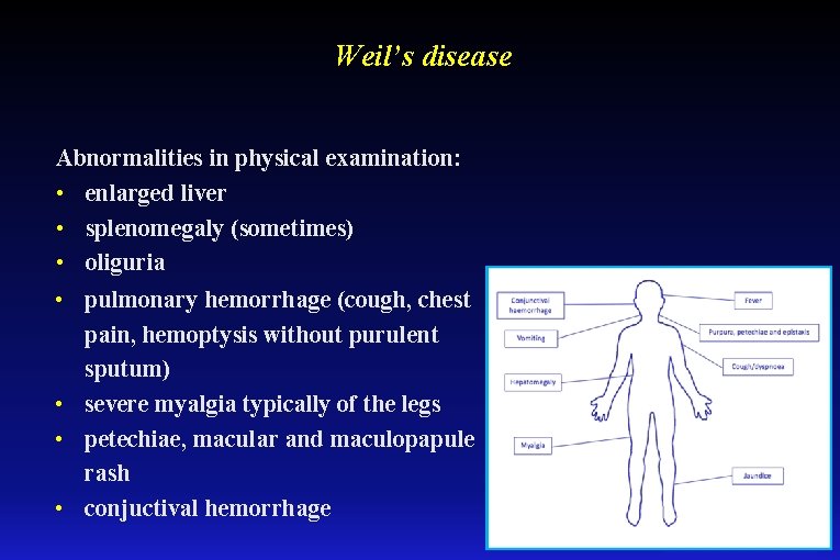 Weil’s disease Abnormalities in physical examination: • enlarged liver • splenomegaly (sometimes) • oliguria