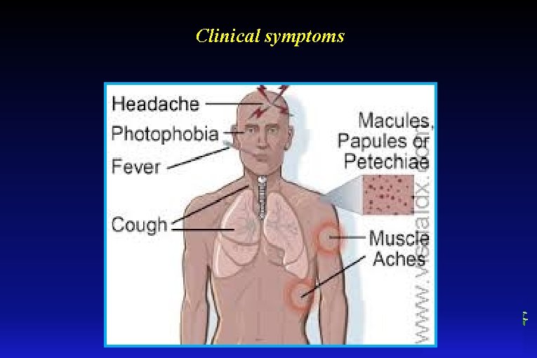 Clinical symptoms 