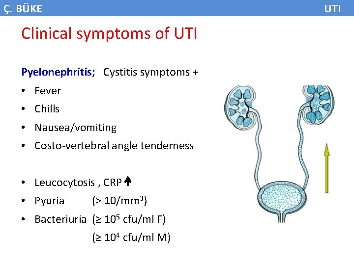 Ç. BÜKE UTI Clinical symptoms of UTI Pyelonephritis; Cystitis symptoms + • Fever •
