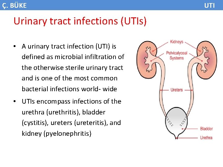 Ç. BÜKE Urinary tract infections (UTIs) • A urinary tract infection (UTI) is defined