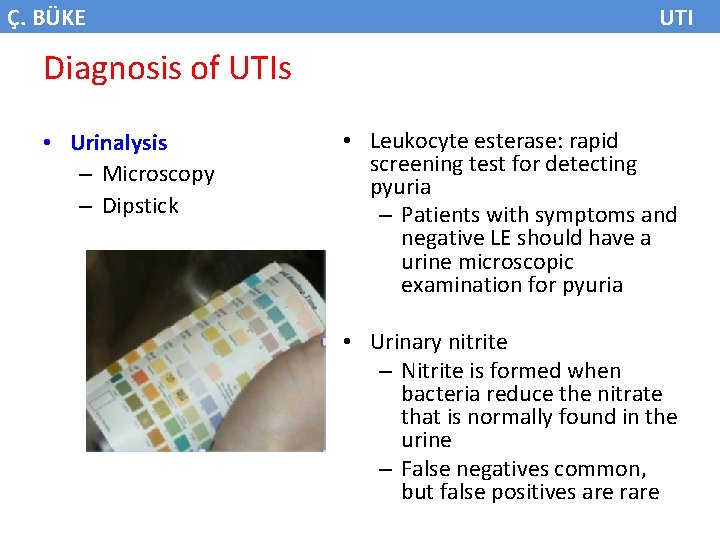 Ç. BÜKE UTI Diagnosis of UTIs • Urinalysis – Microscopy – Dipstick • Leukocyte