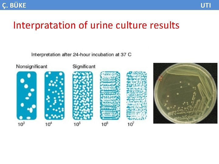 Ç. BÜKE Interpratation of urine culture results UTI 