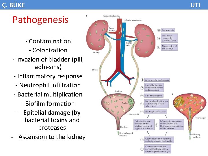 Ç. BÜKE Pathogenesis - Contamination - Colonization - Invazion of bladder (pili, adhesins) -