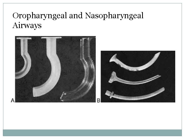 Oropharyngeal and Nasopharyngeal Airways 