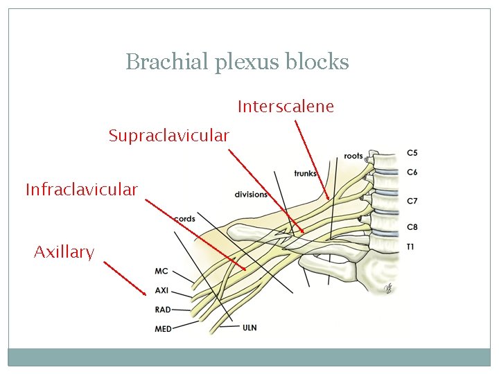 Brachial plexus blocks Interscalene Supraclavicular Infraclavicular Axillary 