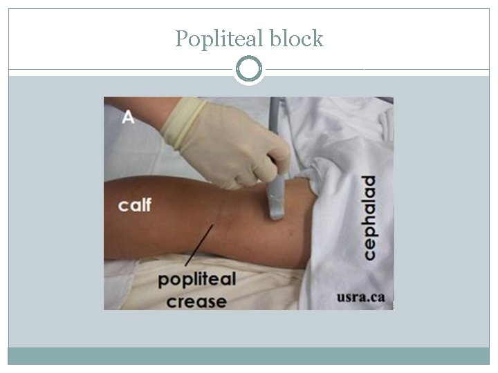Popliteal block 