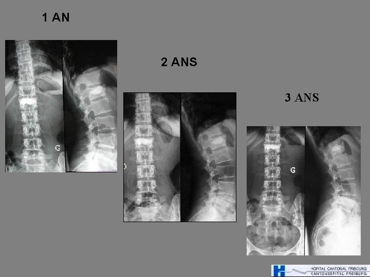 1 AN 2 ANS 3 ANS 