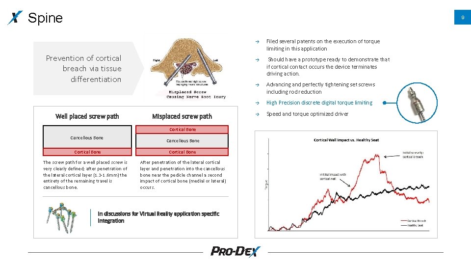 Spine 9 Prevention of cortical breach via tissue differentiation Well placed screw path Misplaced