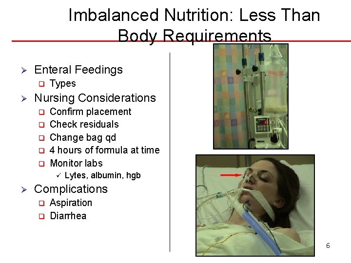 Imbalanced Nutrition: Less Than Body Requirements Ø Enteral Feedings q Ø Types Nursing Considerations