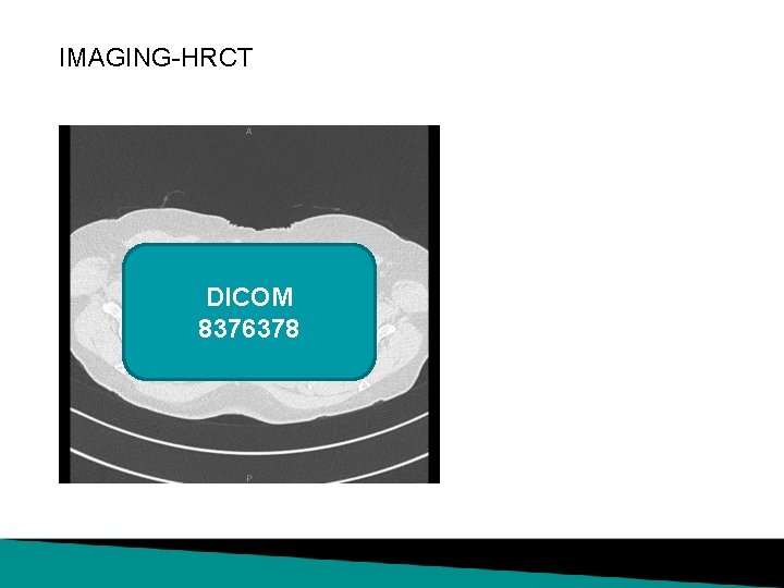 IMAGING-HRCT DICOM 8376378 