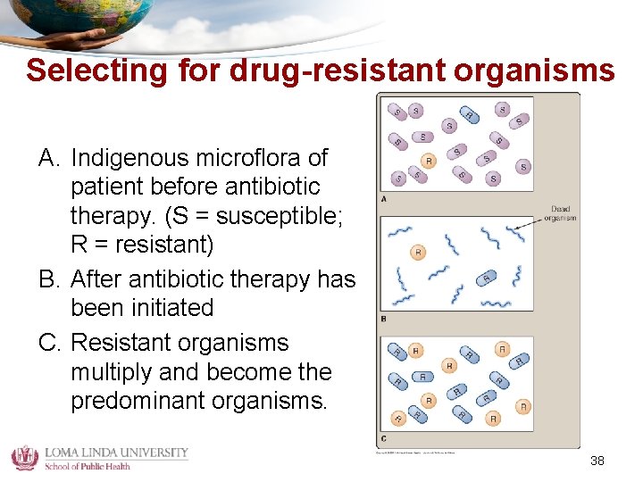 Selecting for drug-resistant organisms A. Indigenous microflora of patient before antibiotic therapy. (S =