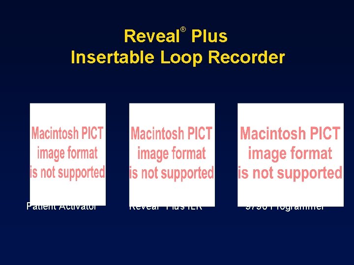 ® Reveal Plus Insertable Loop Recorder Patient Activator Reveal® Plus ILR 9790 Programmer 