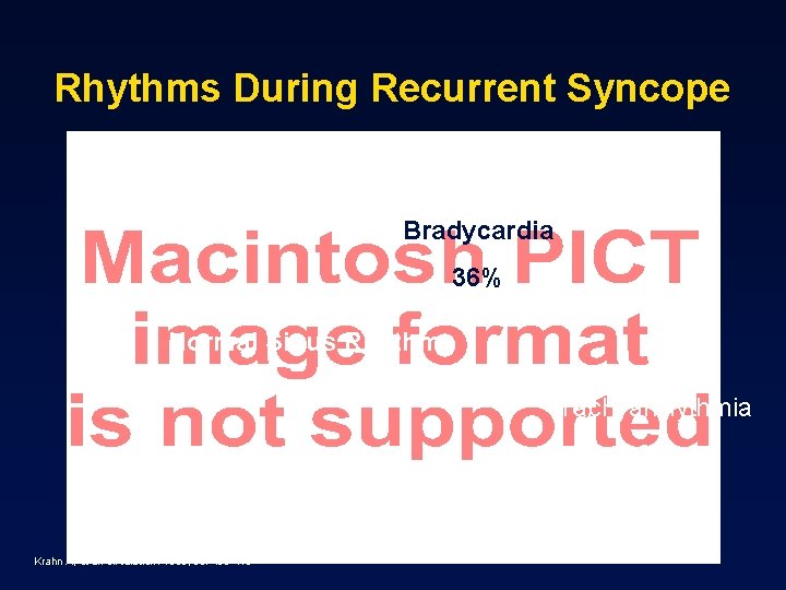 Rhythms During Recurrent Syncope Bradycardia 36% Normal Sinus Rhythm 58% Tachyarrhythmia 6% Krahn A,