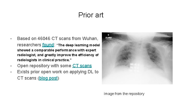 Prior art - Based on 46046 CT scans from Wuhan, researchers found: “The deep