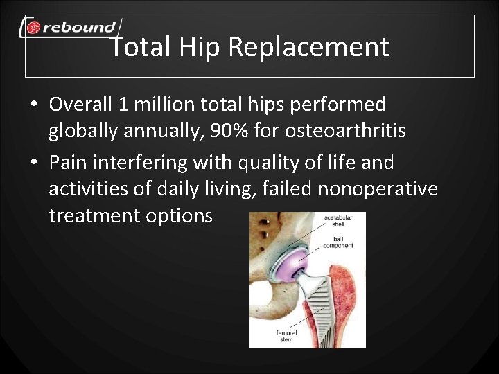 Total Hip Replacement • Overall 1 million total hips performed globally annually, 90% for