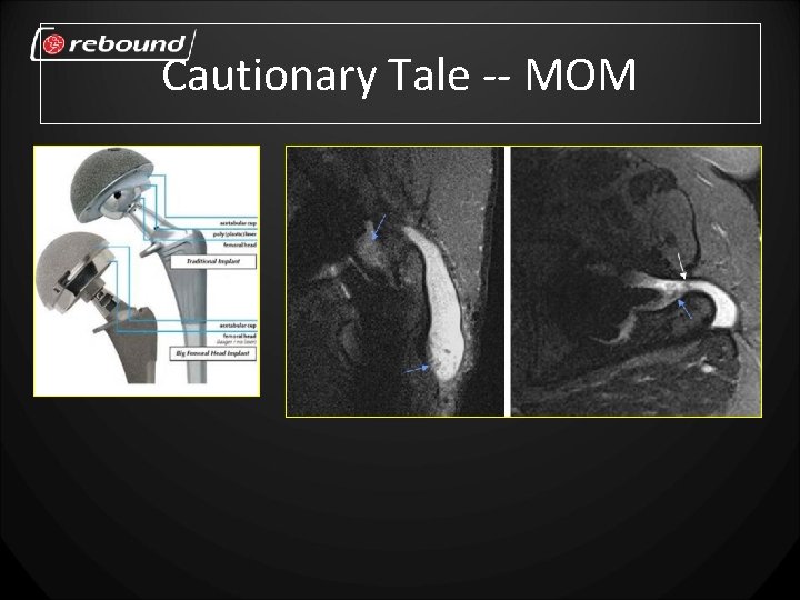 Cautionary Tale -- MOM 