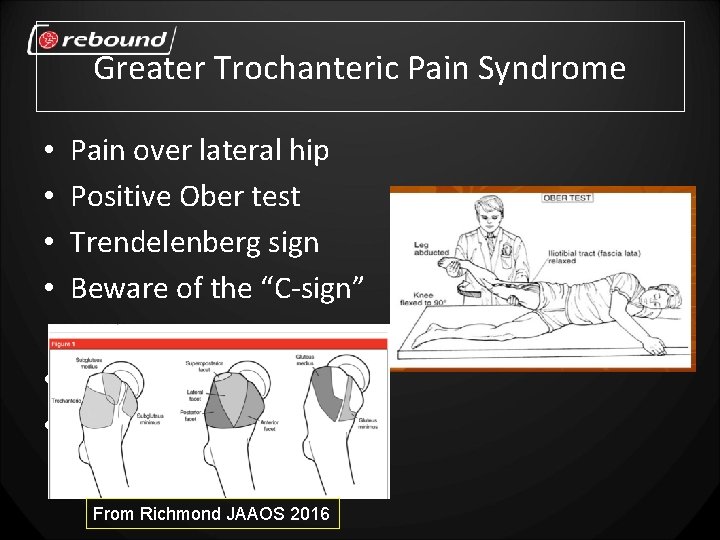 Greater Trochanteric Pain Syndrome • • Pain over lateral hip Positive Ober test Trendelenberg