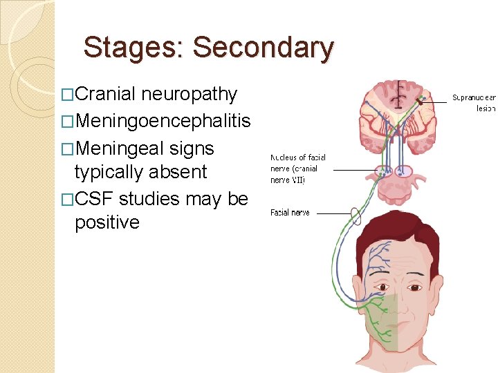 Stages: Secondary �Cranial neuropathy �Meningoencephalitis �Meningeal signs typically absent �CSF studies may be positive