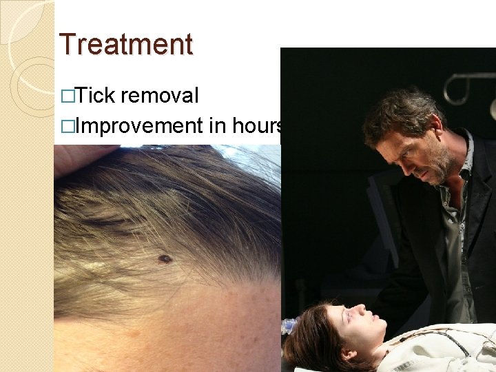 Treatment �Tick removal �Improvement in hours 