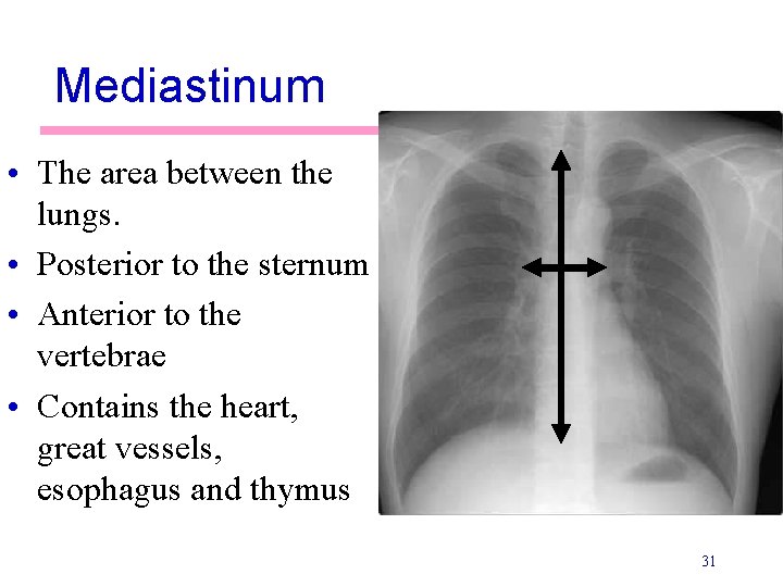 Mediastinum • The area between the lungs. • Posterior to the sternum • Anterior