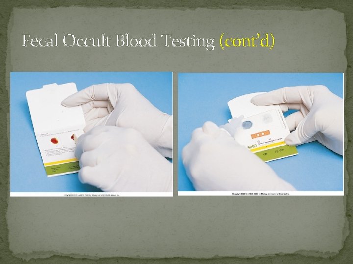 Fecal Occult Blood Testing (cont’d) 