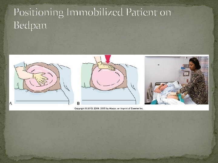 Positioning Immobilized Patient on Bedpan Positioning Immobilized Patient on Bedpan