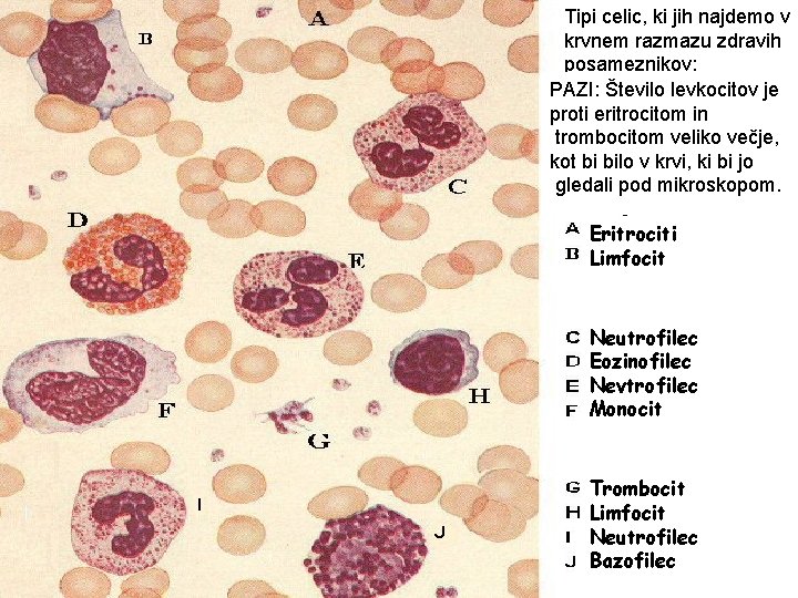 Tipi celic, ki jih najdemo v krvnem razmazu zdravih posameznikov: PAZI: Število levkocitov je