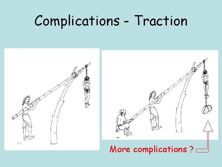 Complications - Traction More complications ? 