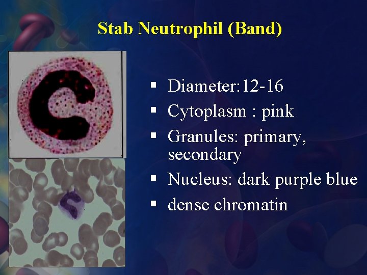 Stab Neutrophil (Band) § Diameter: 12 -16 § Cytoplasm : pink § Granules: primary,