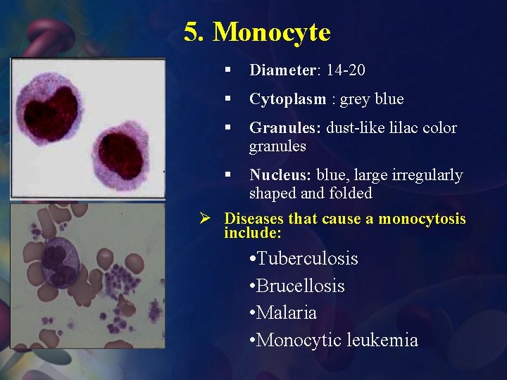 5. Monocyte § Diameter: 14 -20 § Cytoplasm : grey blue § Granules: dust-like