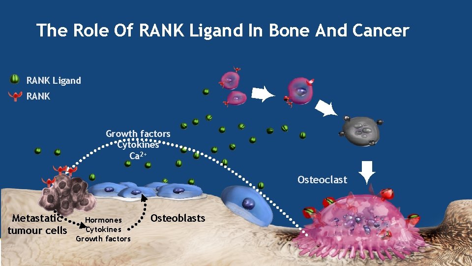 The Role Of RANK Ligand In Bone And Cancer RANK Ligand ➨ RANK ➨