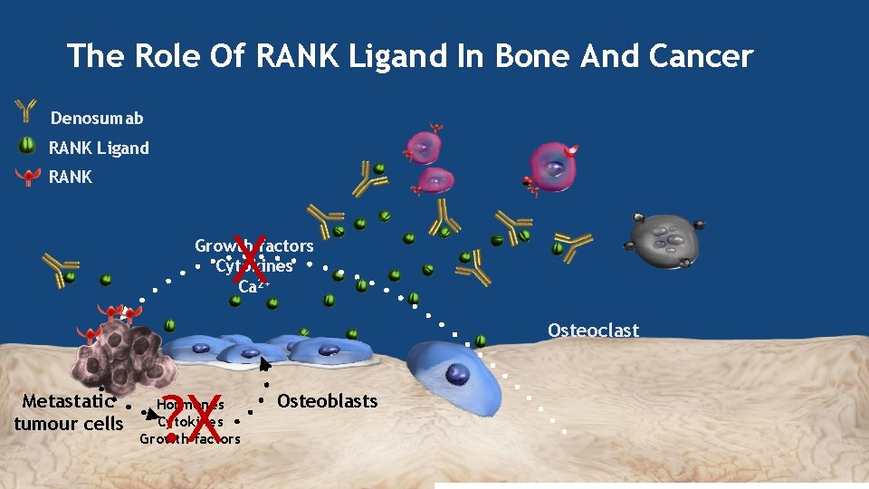 The Role Of RANK Ligand In Bone And Cancer Denosumab RANK Ligand RANK X