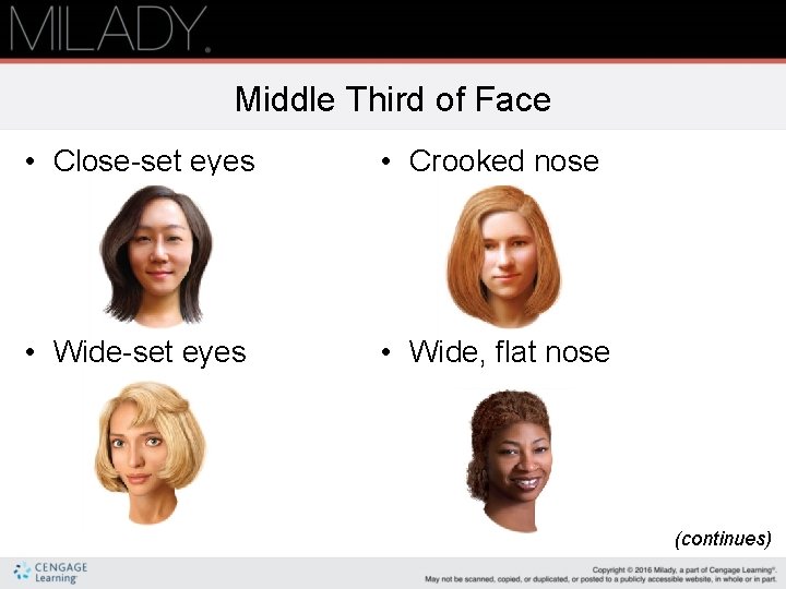 Middle Third of Face • Close-set eyes • Crooked nose • Wide-set eyes •