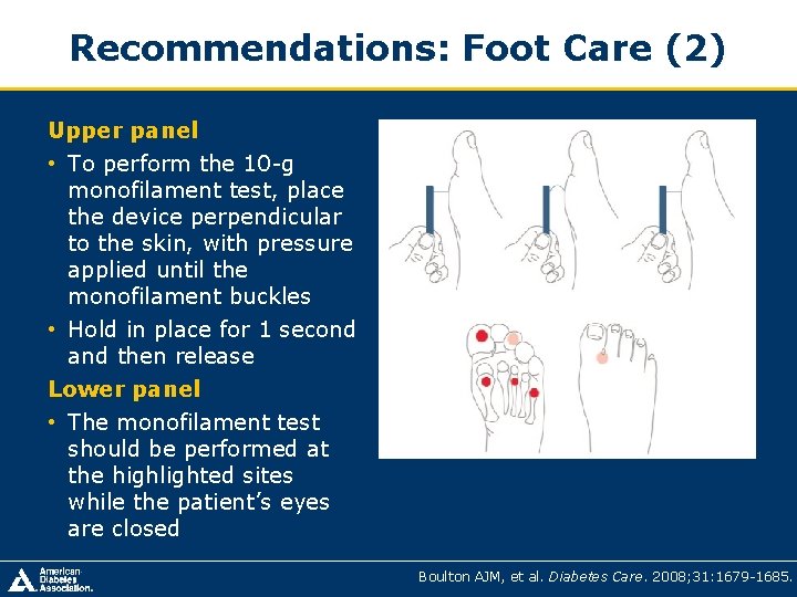 Recommendations: Foot Care (2) Upper panel • To perform the 10 -g monofilament test, Recommendations: Foot Care (2) Upper panel • To perform the 10 -g monofilament test,